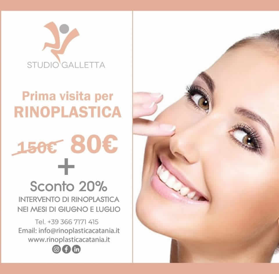 Rinoplastica Catania